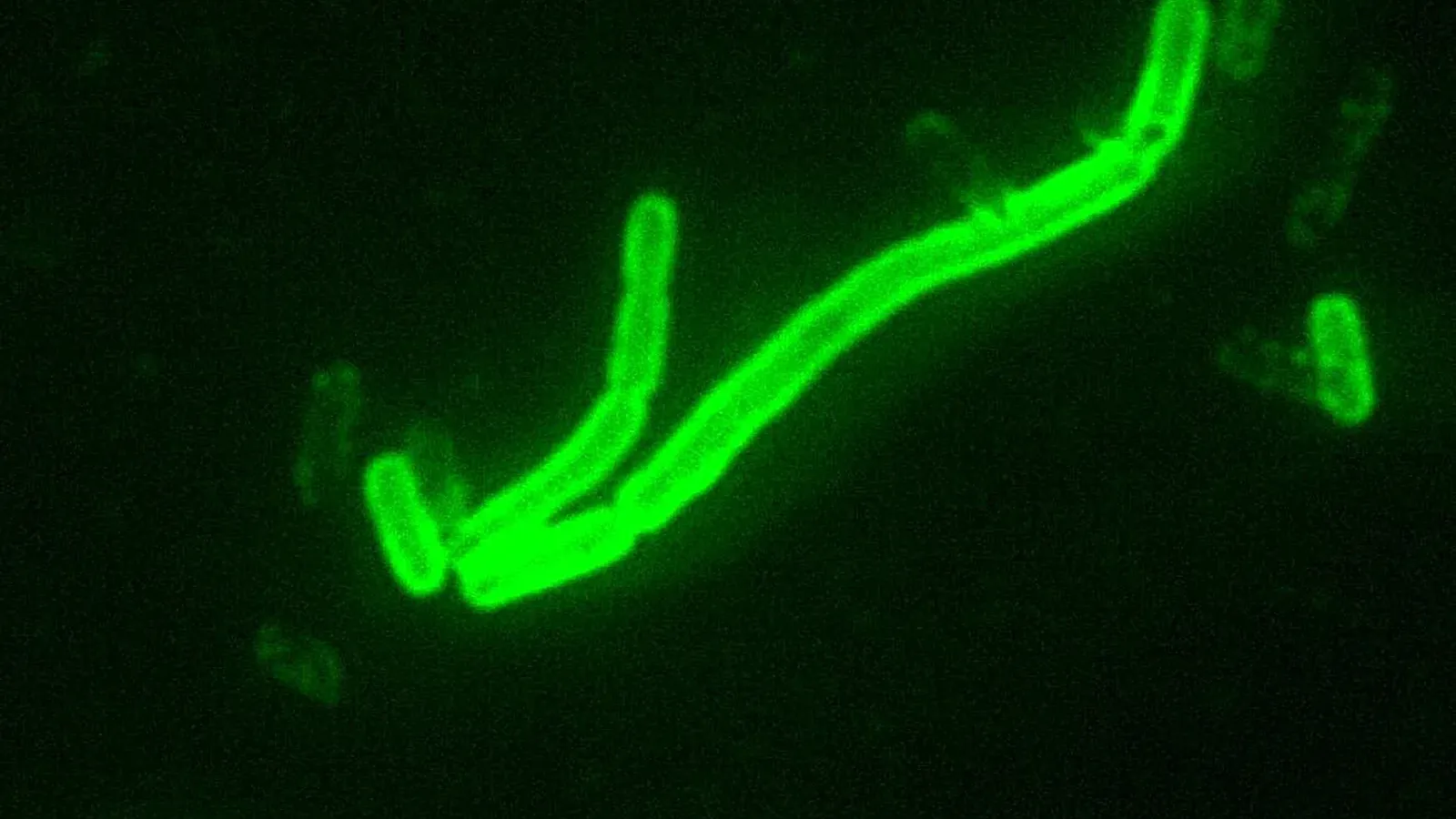 ภาพถ่ายผ่านกล้องจุลทรรศน์ของแบคทีเรีย Yersinia pestis เชื้อก่อกาฬโรคและกาฬโรคปอด ย้อมด้วยสารเรืองแสง (DFA) กำลังขยาย 200 เท่า